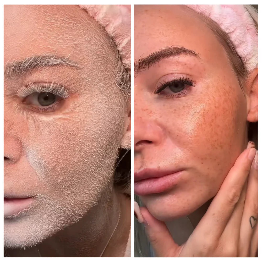 before_after--1