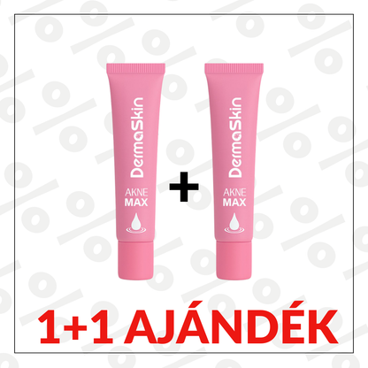 1+1 Ajándék: AkneMax (Extrém gyorsan, napok alatt eltünteti az aknét, pattanást és a mitesszert)