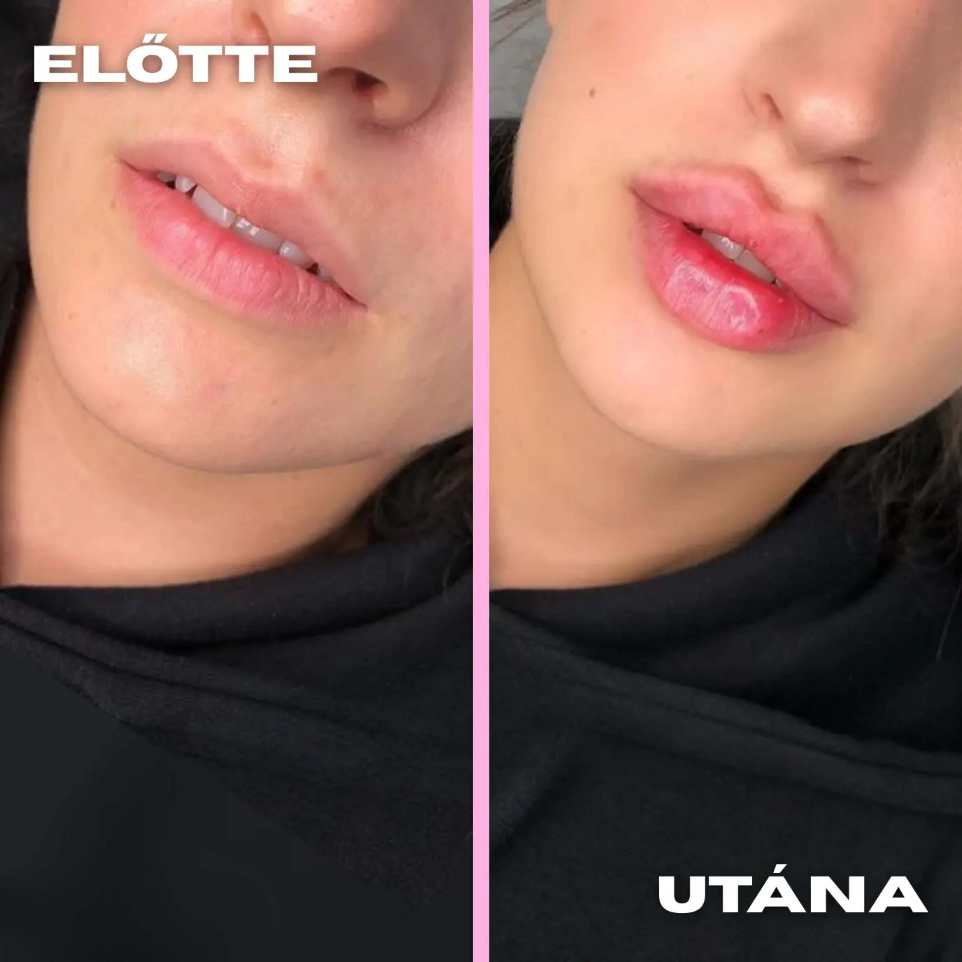 before_after--1