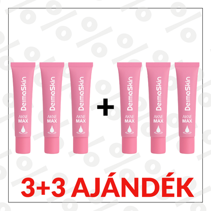 3+3 Ajándék AkneMax (Extrém gyorsan, napok alatt eltünteti az aknét, pattanást és a mitesszert)