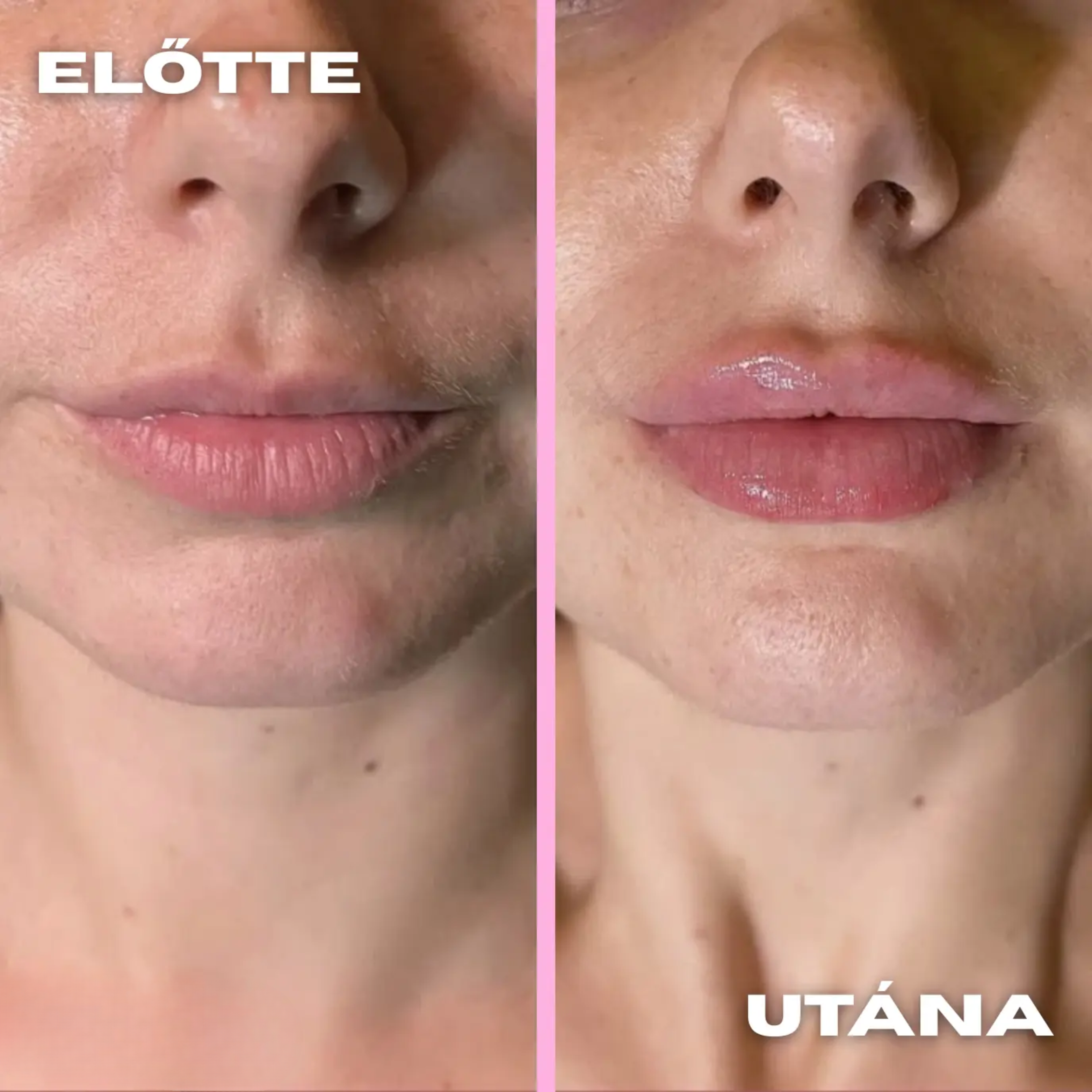 before_after--3