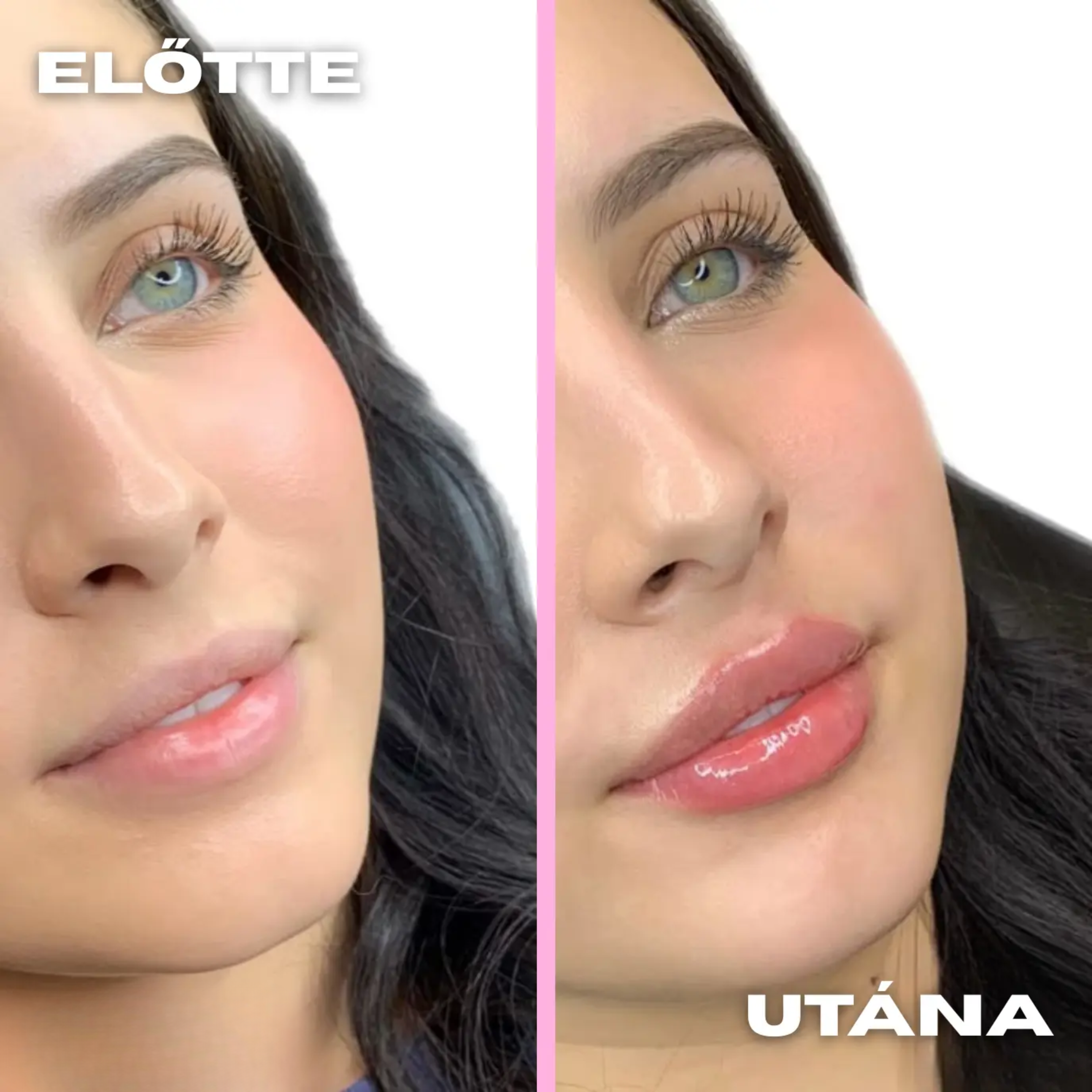 before_after--2