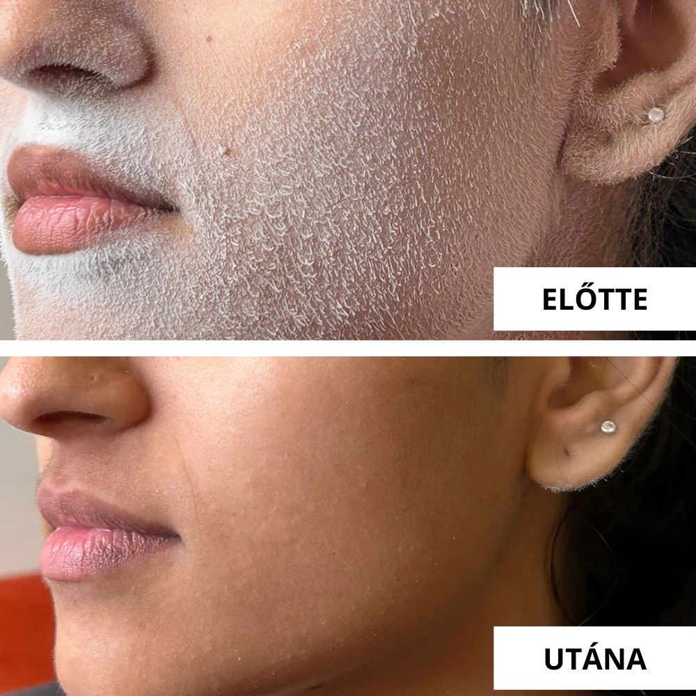 before_after--2