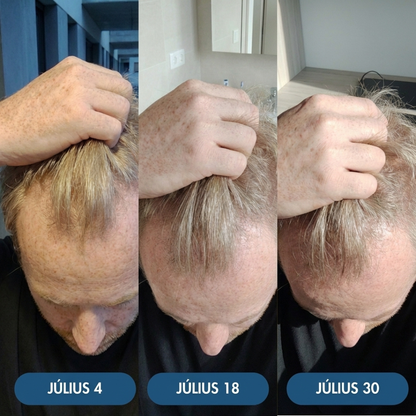 4db USA Hair Elixir Férfiaknak - Extrém Hatékonyan Beindítja A Hajnövekedést & Megállítja A Hajhullást