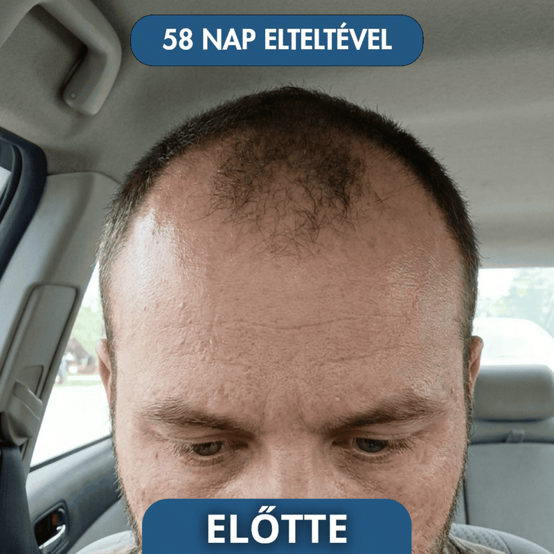 Slider Image 5