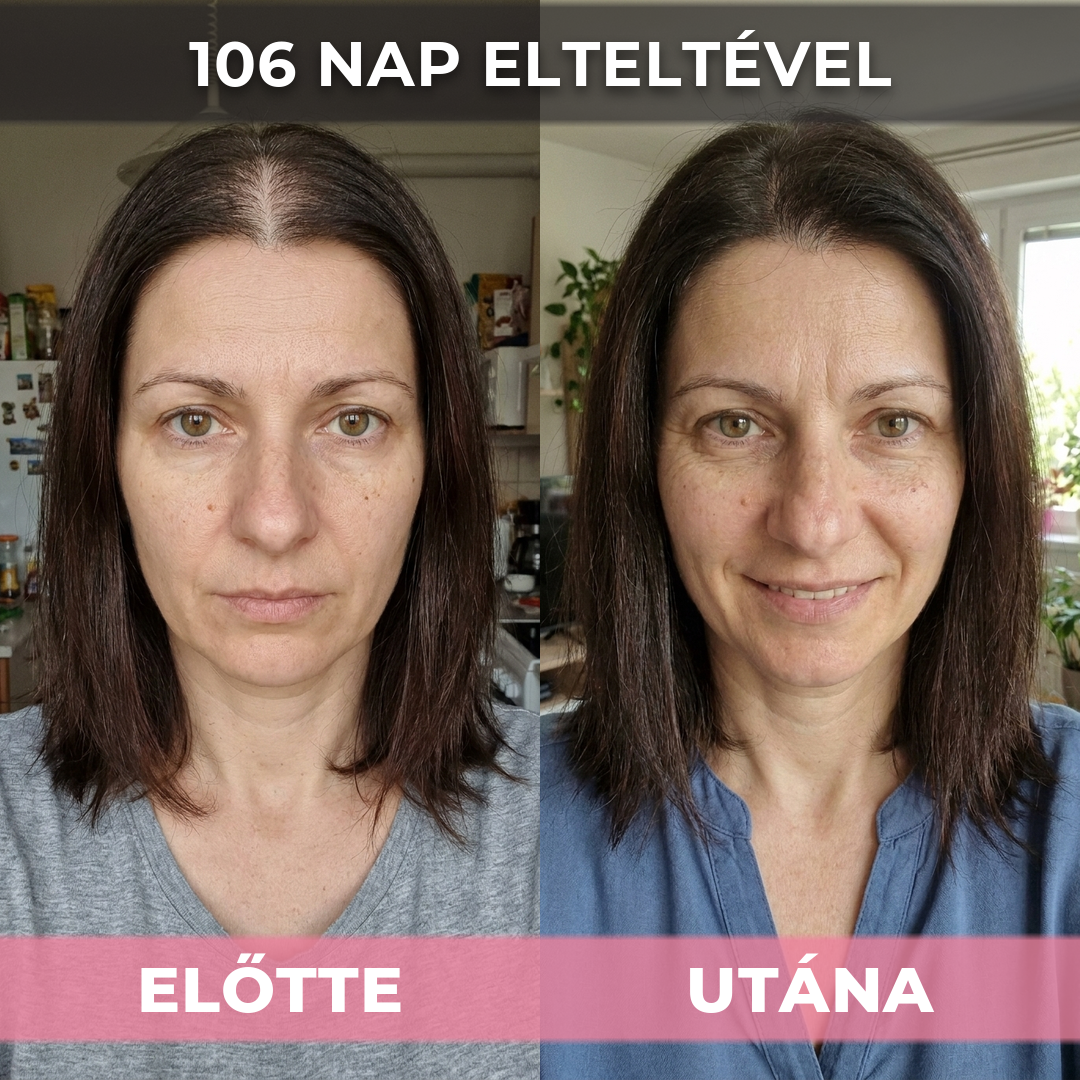 2db USA Hair Elixir Nőknek - Extrém Hatékonyan Beindítja A Hajnövekedést & Megállítja A Hajhullást