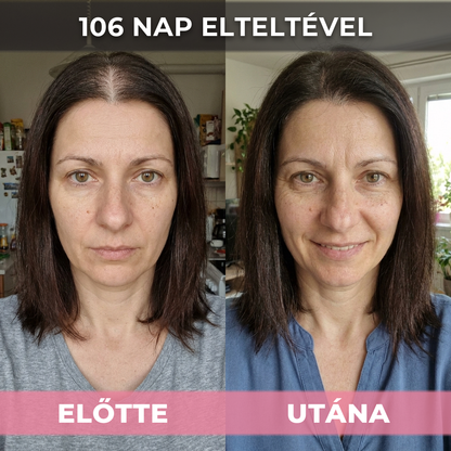 2db USA Hair Elixir Nőknek - Extrém Hatékonyan Beindítja A Hajnövekedést & Megállítja A Hajhullást
