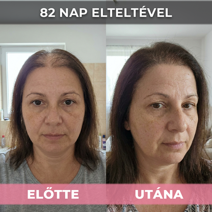 2db USA Hair Elixir Nőknek - Extrém Hatékonyan Beindítja A Hajnövekedést & Megállítja A Hajhullást