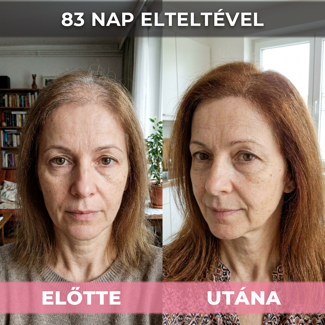 2db USA Hair Elixir Nőknek - Extrém Hatékonyan Beindítja A Hajnövekedést & Megállítja A Hajhullást