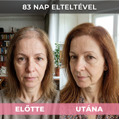 2db USA Hair Elixir Nőknek - Extrém Hatékonyan Beindítja A Hajnövekedést & Megállítja A Hajhullást