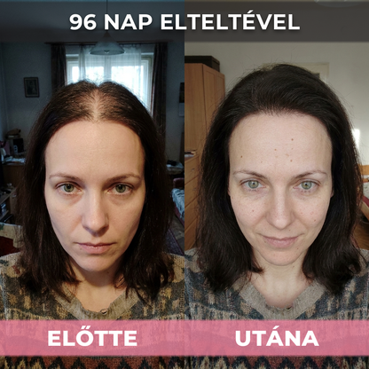 2db USA Hair Elixir Nőknek - Extrém Hatékonyan Beindítja A Hajnövekedést & Megállítja A Hajhullást