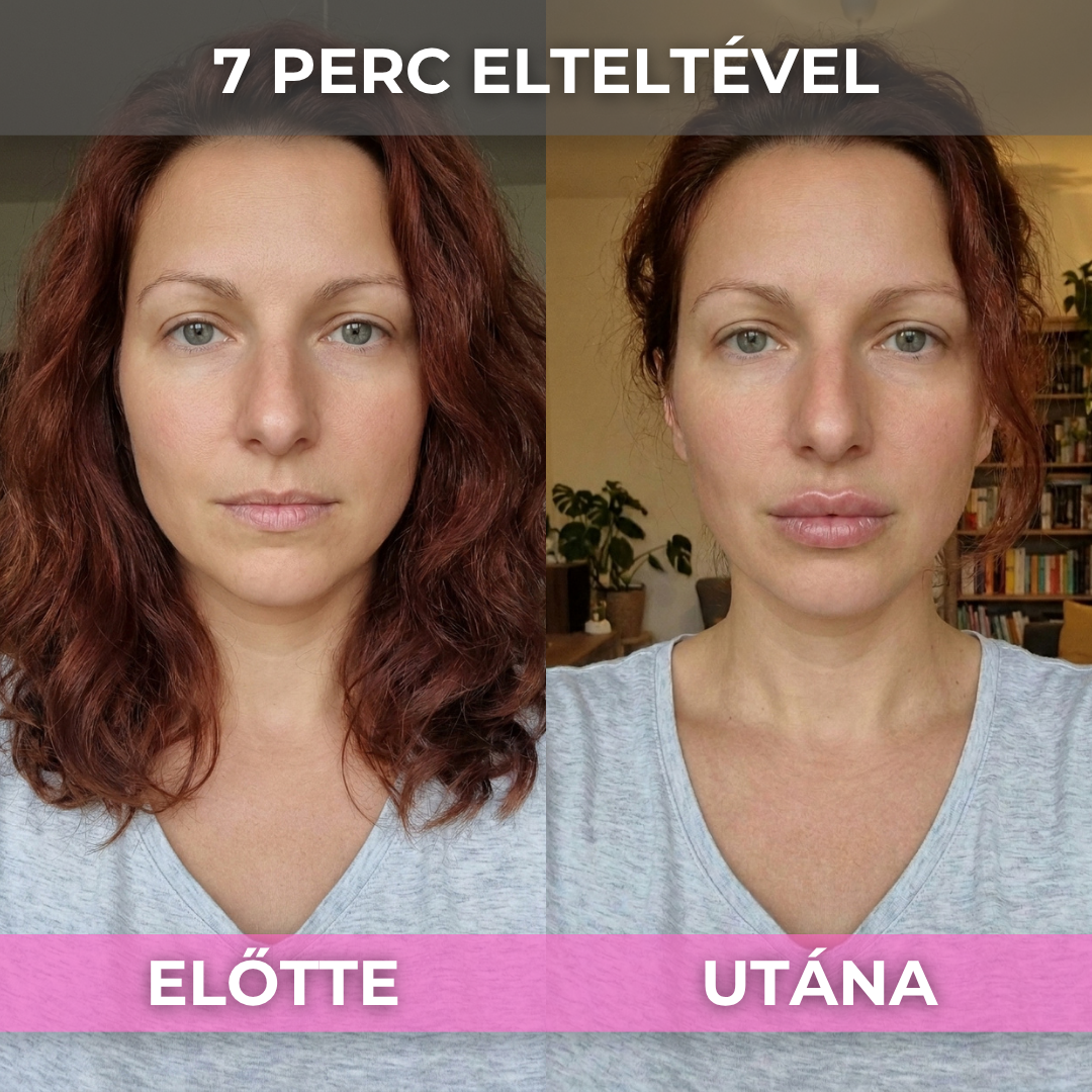 2+2 Ajándék ShineLips - Extrém Ajakdúsító Szájfény (Fájdalom És Csípő Érzés Nélkül Dúsítja Ajkaid)