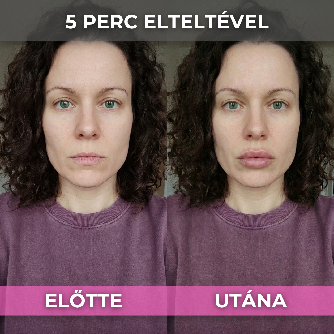 2+2 Ajándék ShineLips - Extrém Ajakdúsító Szájfény (Fájdalom És Csípő Érzés Nélkül Dúsítja Ajkaid)
