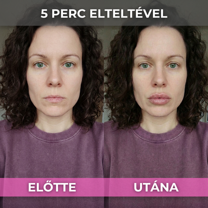 2+2 Ajándék ShineLips - Extrém Ajakdúsító Szájfény (Fájdalom És Csípő Érzés Nélkül Dúsítja Ajkaid)
