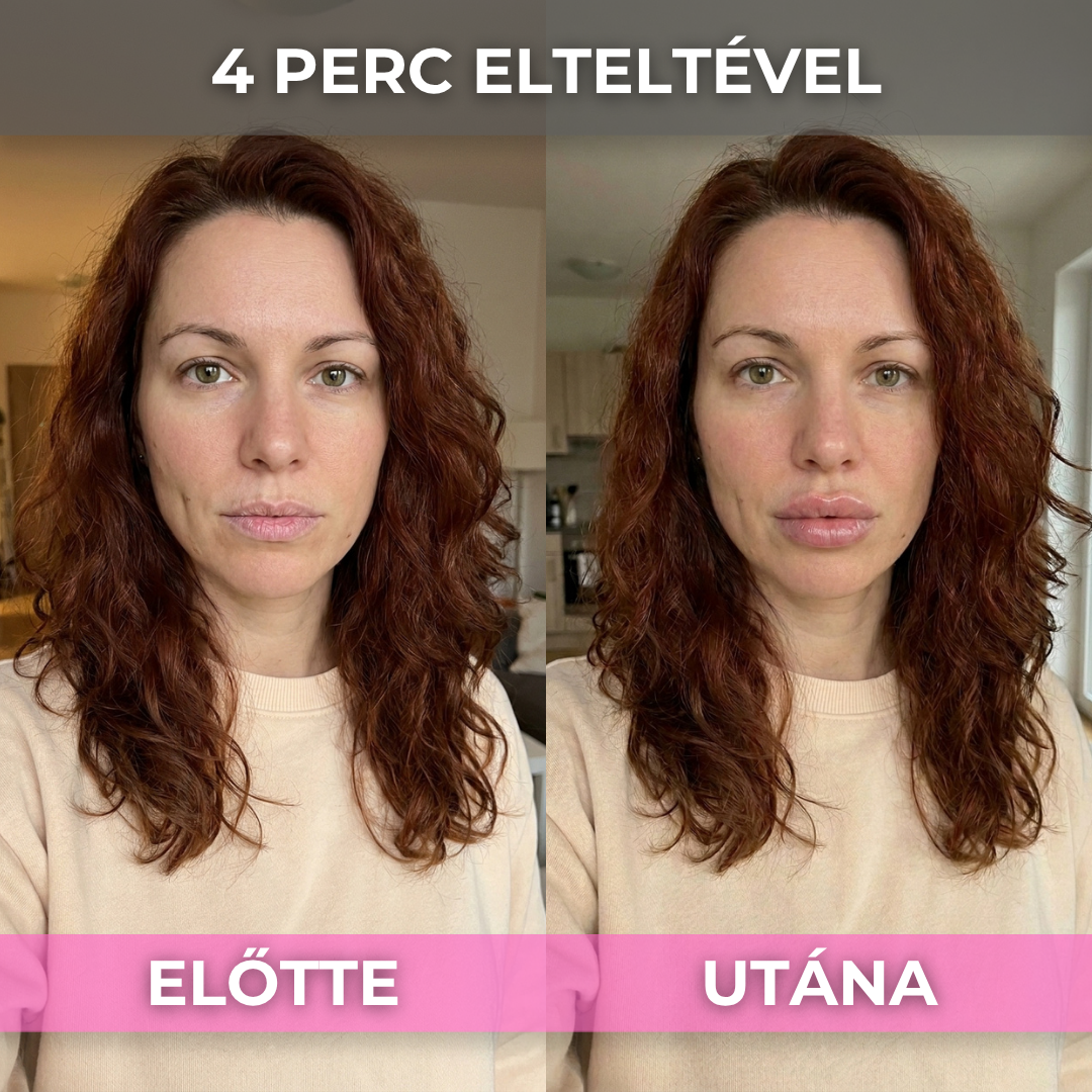 2+2 Ajándék ShineLips - Extrém Ajakdúsító Szájfény (Fájdalom És Csípő Érzés Nélkül Dúsítja Ajkaid)