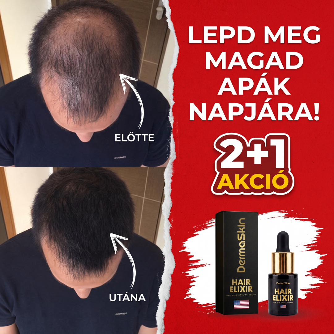 2+1 Ajándék Apák Napjára USA Hair Elixir Férfiaknak - Extrém Hatékonyan Beindítja A Hajnövekedést & Megállítja A Hajhullást