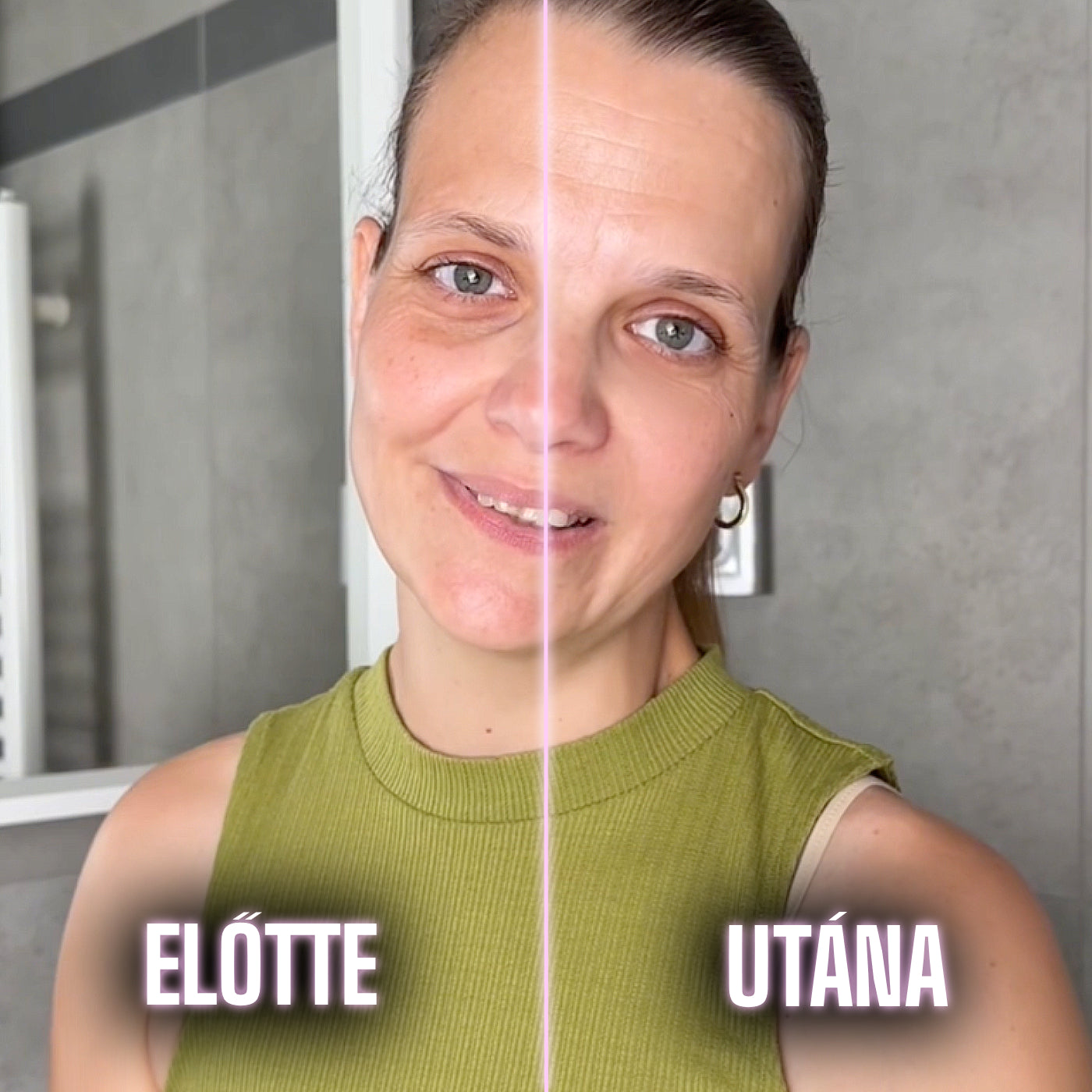 before_after--2