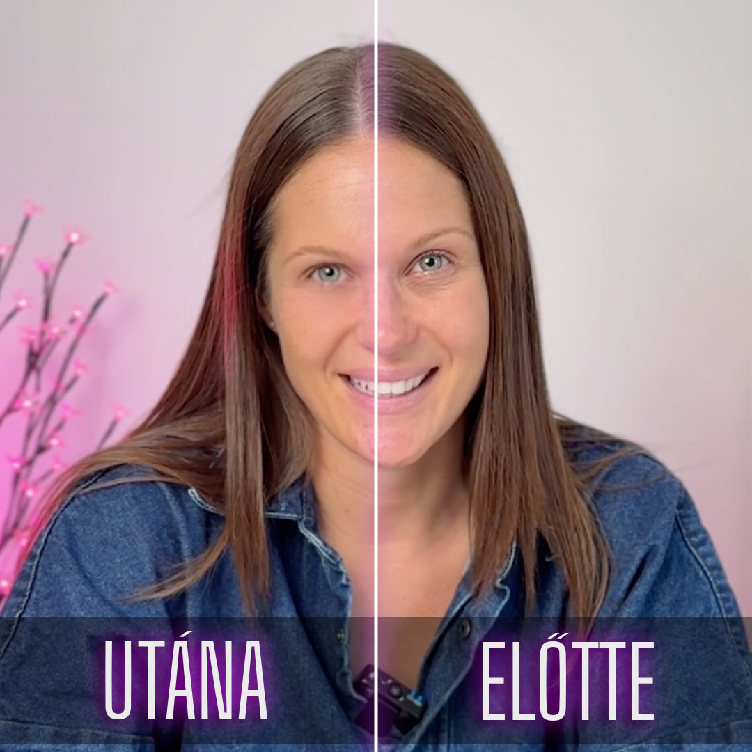 before_after--5